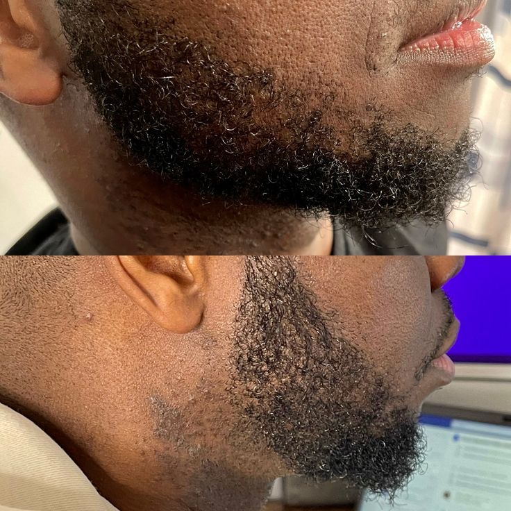 HUILE DE POUSSE DE BARBE