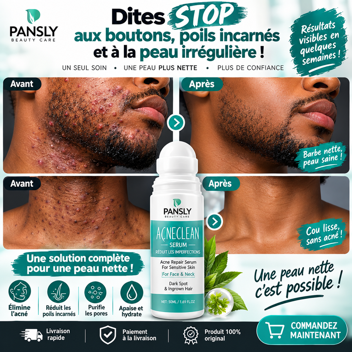 serum anti acné PANSLY