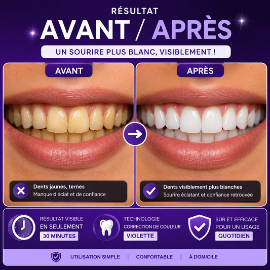 🪥 Blanchisseur de dents