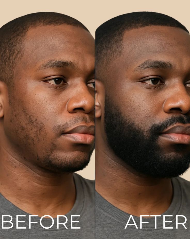 HUILE DE POUSSE DE BARBE